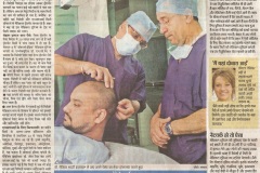 hair-transplant
